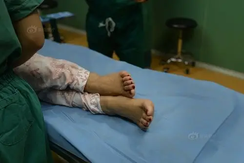 爱美的王琪将自己的脚趾染成红色,但爱美也让她的脚饱受"折磨",这