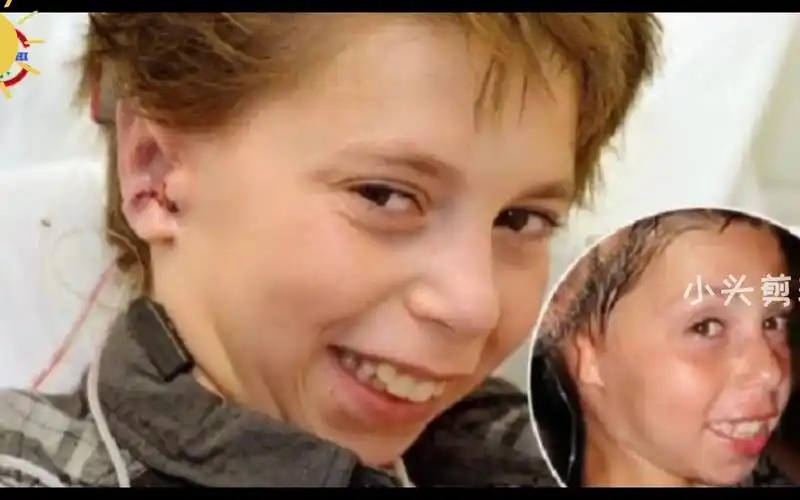 拥有三只耳朵的人类-医学奇迹_哔哩哔哩_bilibili