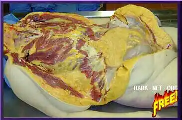 【贴图】部分医学解剖过程图片