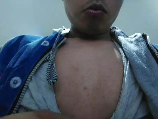 胸前的皮肤为什么是这样的呢