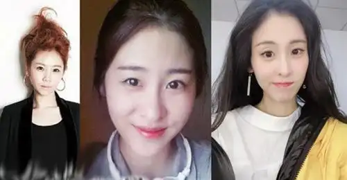 米看皮张碧晨个人资料简介及家庭背景曝光张碧晨整容前真吓人