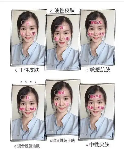 皮肤肤质的分类