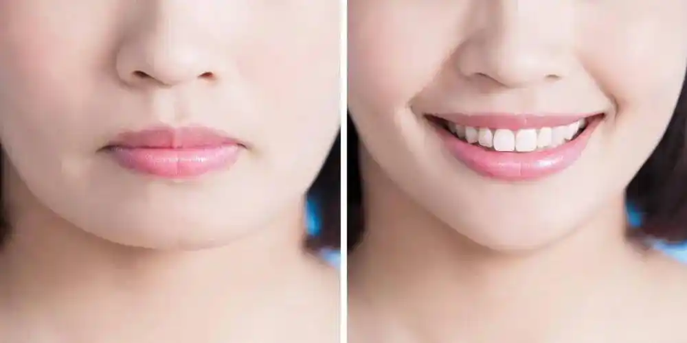 为什么人上了年纪会发腮