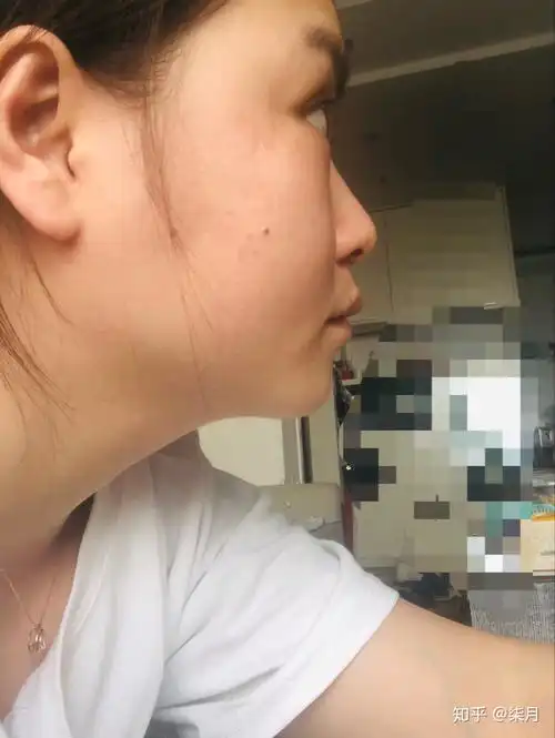 有一个超级扁平的侧脸是一种什么样的体验?