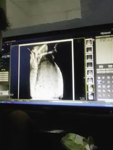 狗妈妈怀孕了能照b超查肝功剖腹产价格要上千