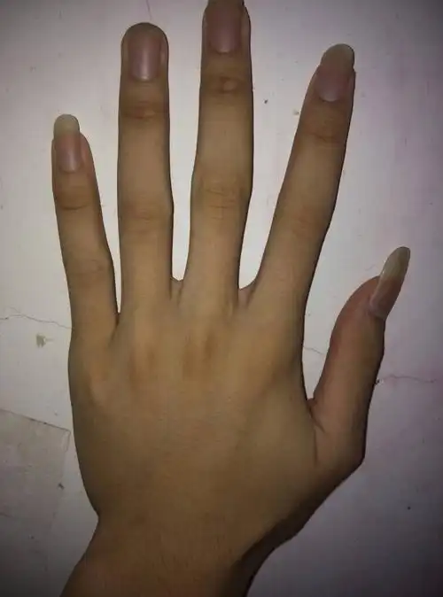 问:为什么我手指这么长啊!