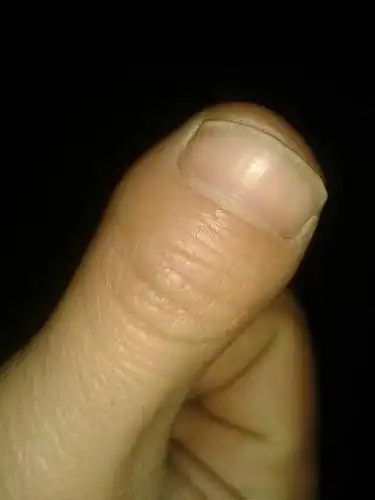 这种手指头如何解释?