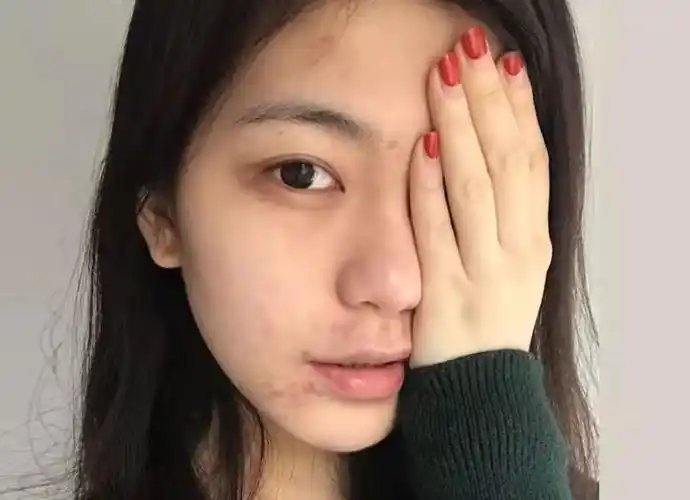 皮肤光滑是什么样的感觉怎么解决脸部粗糙