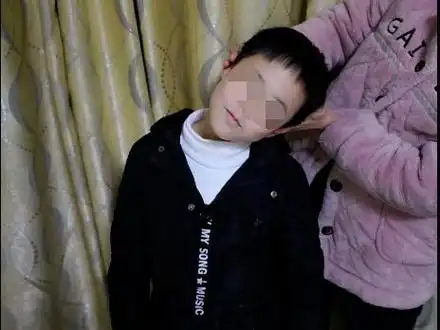 宝宝"歪头"不是萌,当心是肌性斜颈!