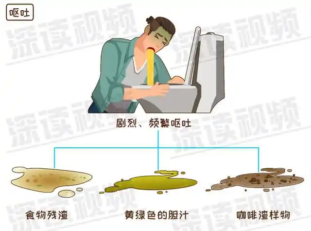 频繁呕吐也是急性胰腺炎的常见症状,呕吐物为食物残渣,黄绿色的胆汁或