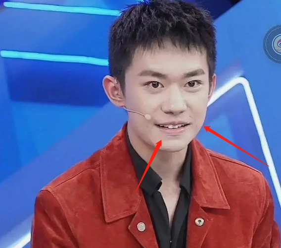 易烊千玺脸部状态差,疑似"发腮"少年感消失,被吐槽丑_手机搜狐网