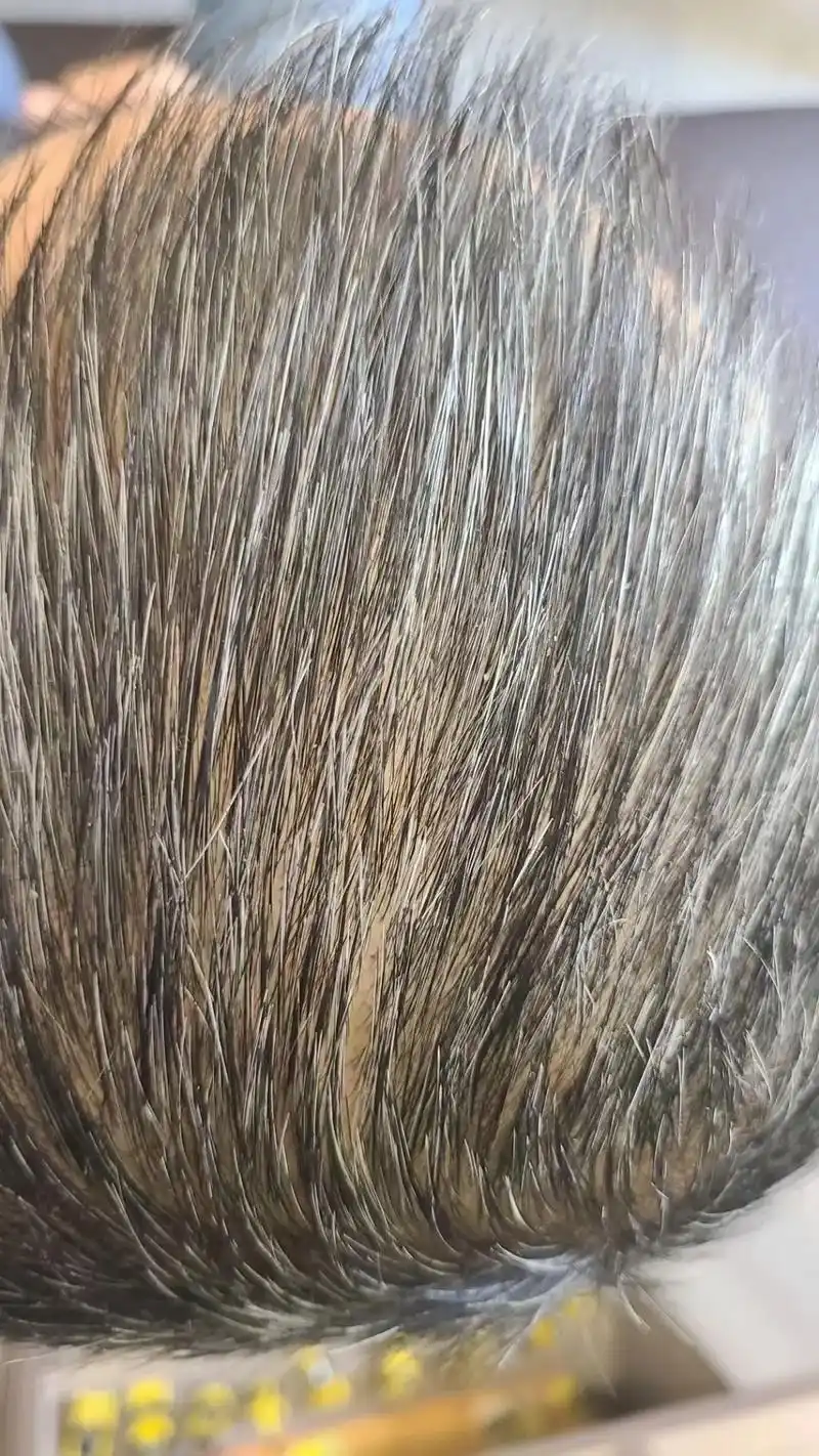 我的头发变黑了.