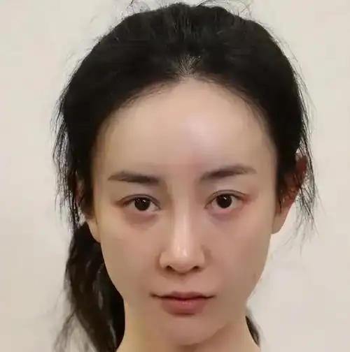 以为她们退圈了,原来是"医美"认不出美人真该远离科技与狠活