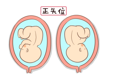 胎儿头位是什么样子的