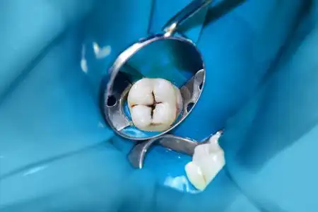 photopolymeric图片-photopolymeric素材-photopolymeric插画-摄图新