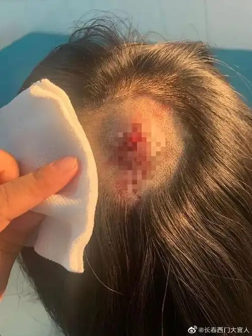 长春一年轻女子当街被爆头这个男的谁认识