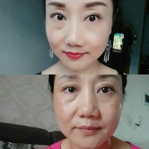 莱芙蔻"抗衰老生命密码护肤品祛斑祛痘去褶皱"产品使用前后惊人对比图