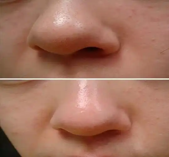 你们要的「收缩毛孔攻略」请务必查收查收!