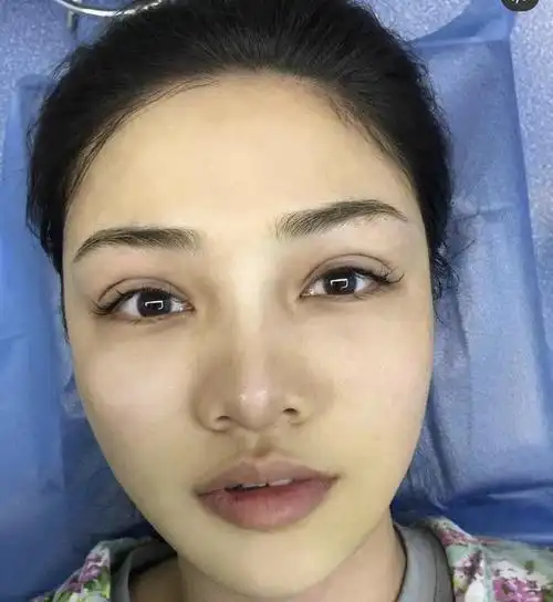 网红双眼皮素颜图片大全