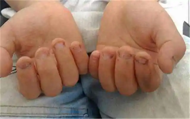 原创从小就爱"咬指甲"的孩子,长大后会怎样?专家:会有这3种后果