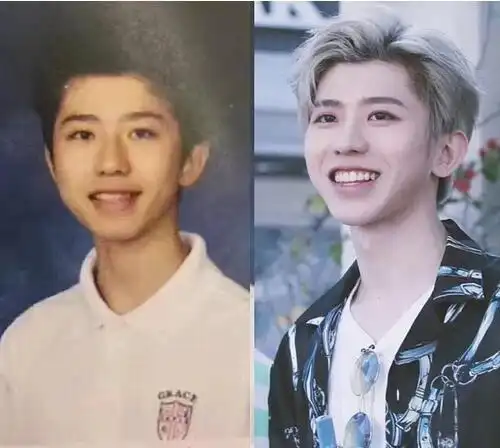 网传蔡徐坤整容是假消息带个牙套也算整从小帅到大