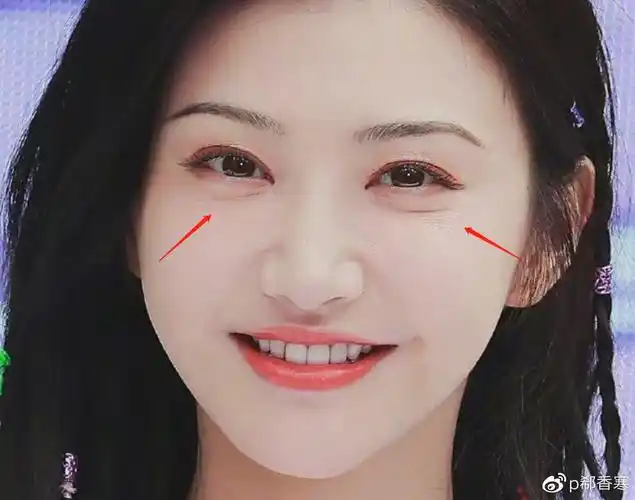 景甜出席活动人气高,却因脸僵被嘲神似唐一菲,网友劝其别打针了