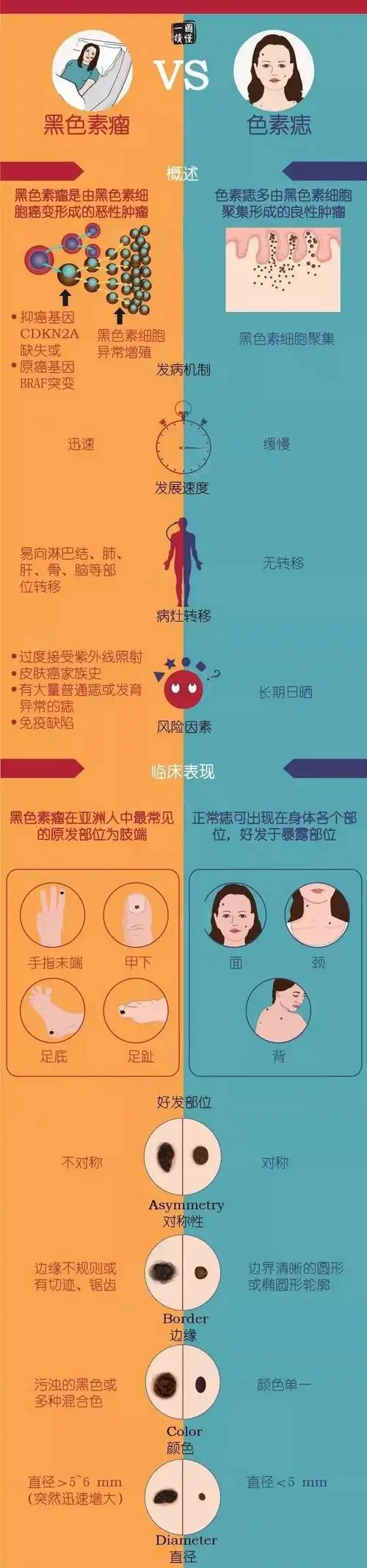 黑色素瘤 vs 色素痣