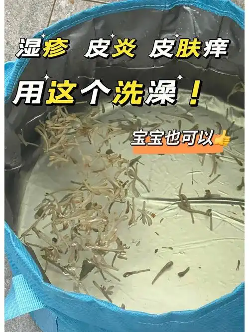 没有想到它还可以治疗宝宝湿疹皮炎皮肤痒