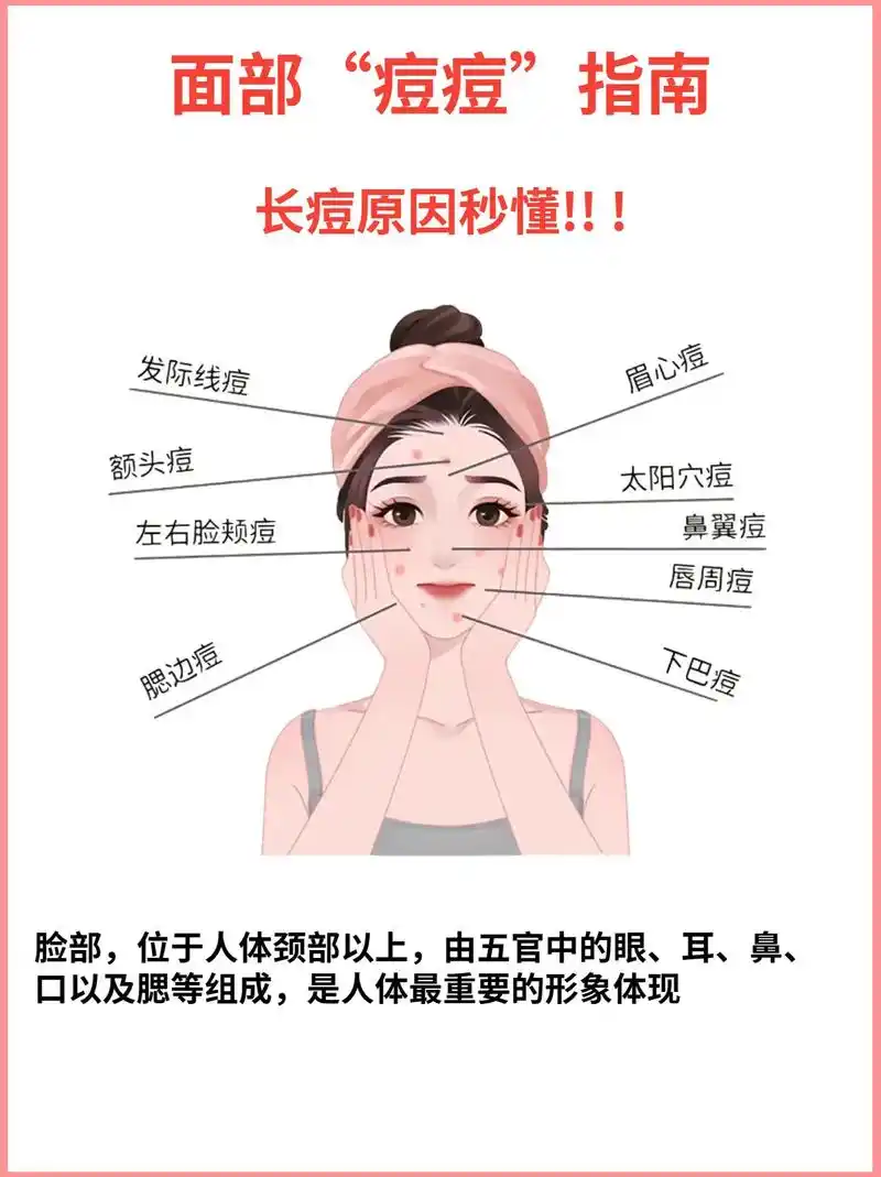 面部"痘痘"指南,让你有针对性解决痘痘!教你轻松看懂面部各 - 抖音