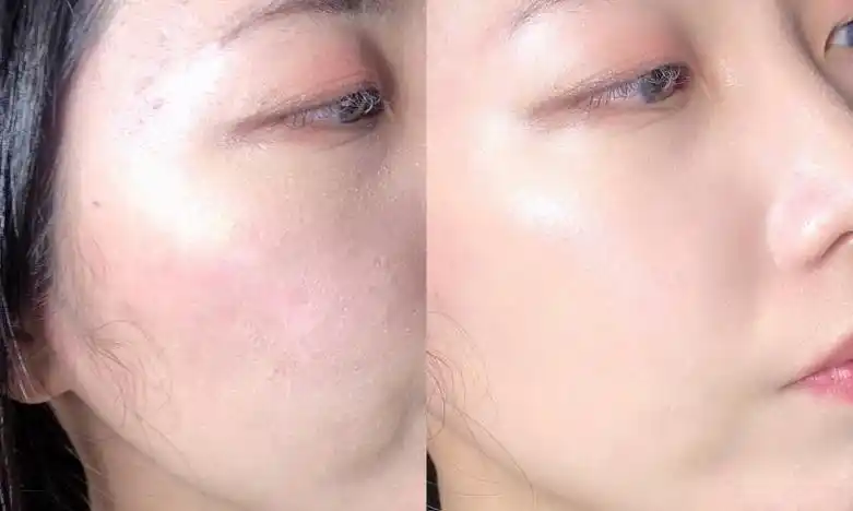 大家先看这张图,了解一下皮肤屏障,就是由皮脂膜 角质层共同构成的