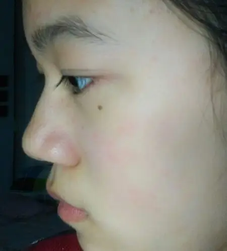 这样的鼻子算塌吗?