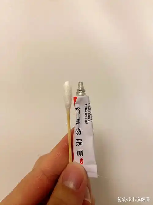 鼻炎,亲测有用 红霉素眼膏药房买的4r一支2g,下午用了晚上鼻子就不痒