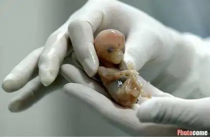 个月的宝宝已经是一个人形婴儿了, | 妈妈网轻聊_千万女人的共同选择