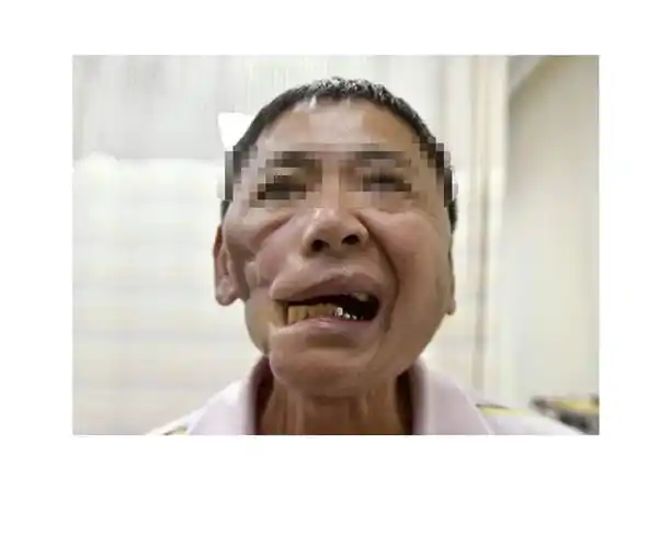 每16秒就有一个中国人死于这种病