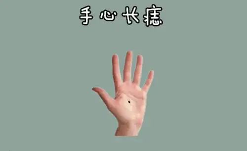 身体5颗横财痣,男人车房不愁,女人发财不愁,马上走大运!