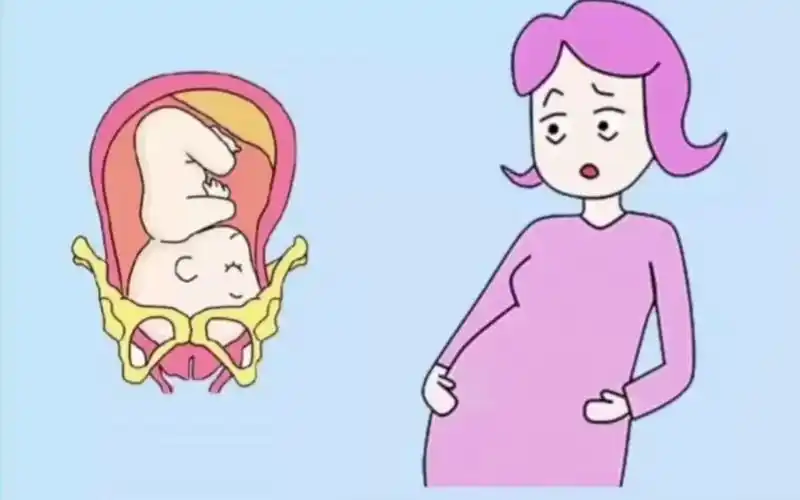 胎儿入盆孕妈有什么感觉?你有哪几种感觉?