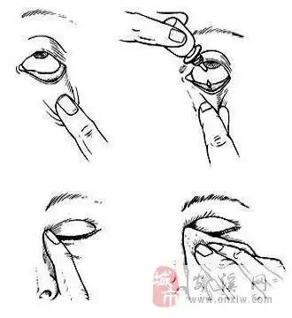 滴眼药水你做对了吗