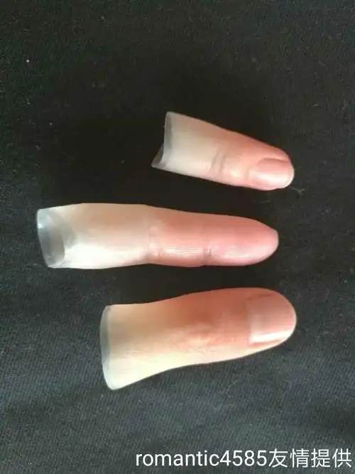 大拇指断了半节不能打弯其他手指还在康复运动中