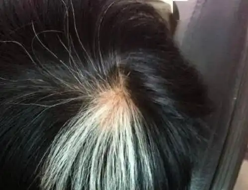 白发从哪里长,病从哪里来,长在两鬓,前额,头顶分别暗示什么?