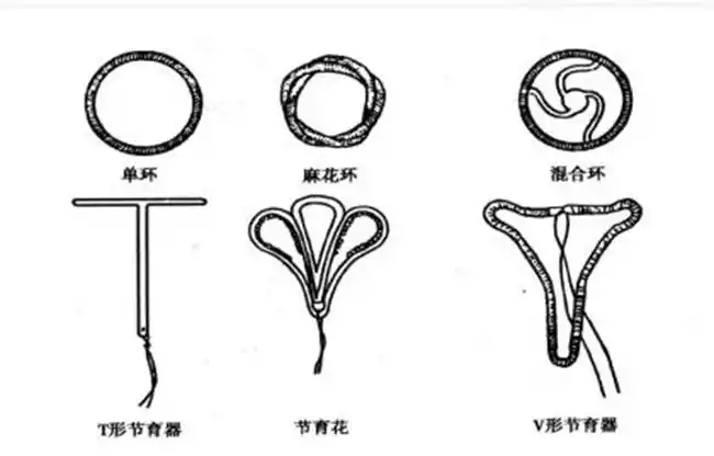遗忘的2600万中国女性现身体受到节育环威胁