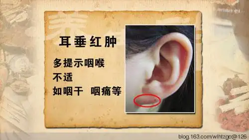 看耳朵能知道人的寿命长短常见病耳诊与按摩保健