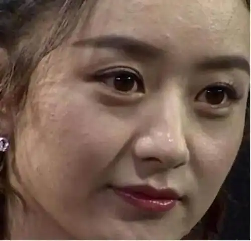 芭莎慈善夜上,也被人拍到皮肤状态差的照片,满脸的粉刺痘痘,眼袋也