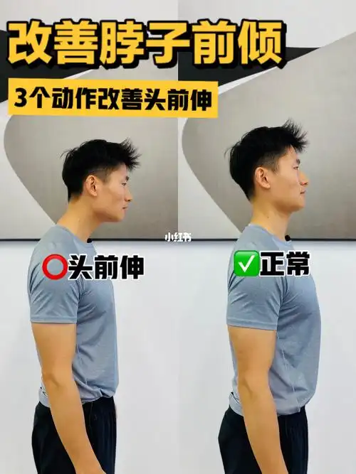 3个动作改善脖子前倾头前引