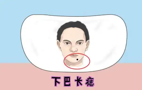 五种"巨富"痣,男人发财,女人显贵,万里挑一的好命!