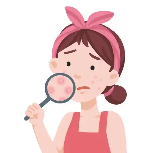 饮食习惯不好,压力过大导致情绪无法调节这些事情,都会导致痘痘的产生