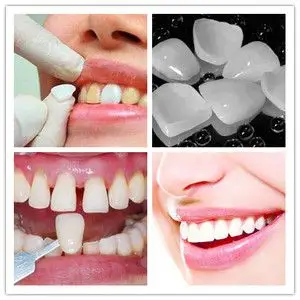 【牙齿贴面】牙齿贴面品牌,价格 - 阿里巴巴