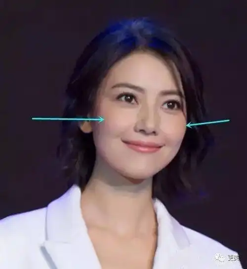娱乐圈高颧骨比较有代表性的女明星就是高圆圆了