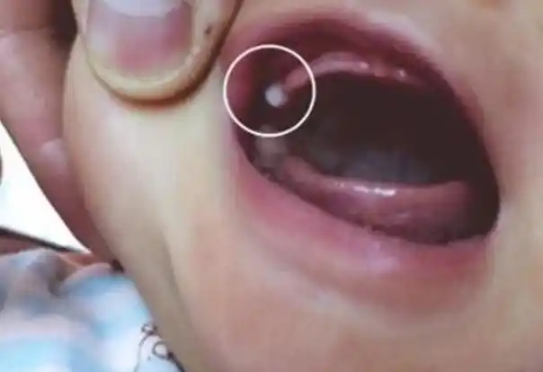 乳牙|母乳|宝宝吃奶|磨牙_网易订阅