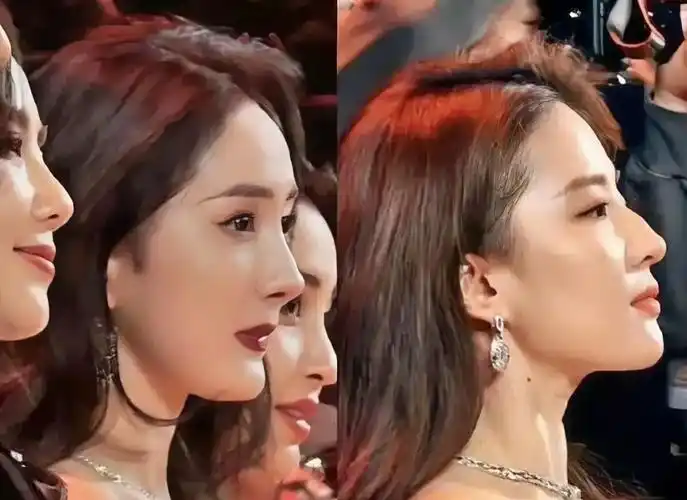 瘪嘴,短下巴导致的"侧脸虐",隐隐约约让人想到了总是被说骨相差的杨幂