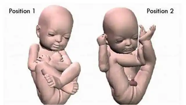 典型案例!孕妇怀男孩的特征"日思夜想"-第2张图片-陌上花网